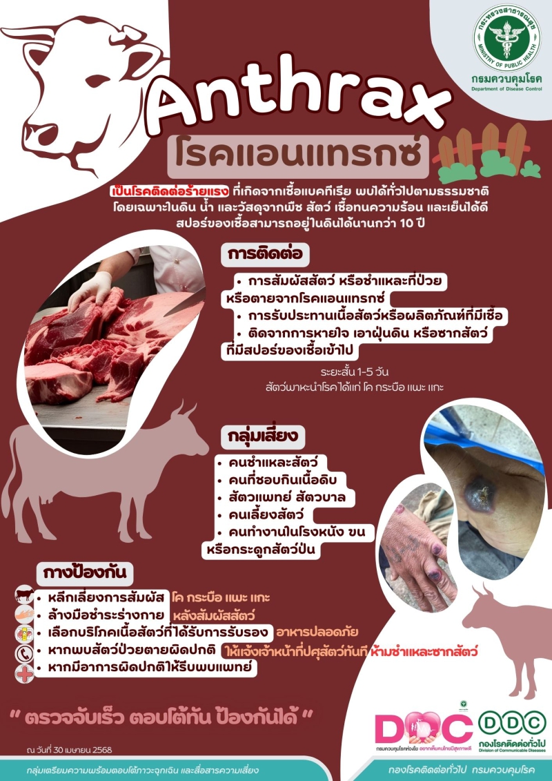 โรคแอนเเทรกซ์